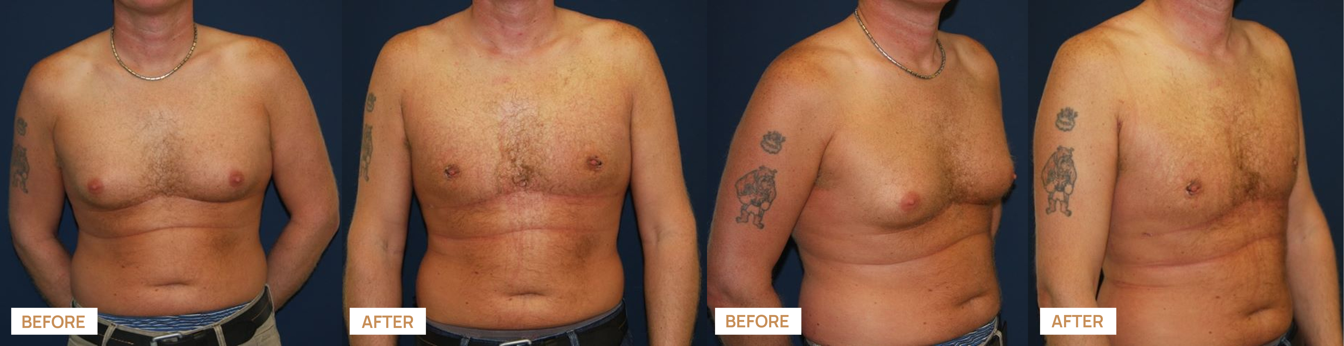 Recovery result 1