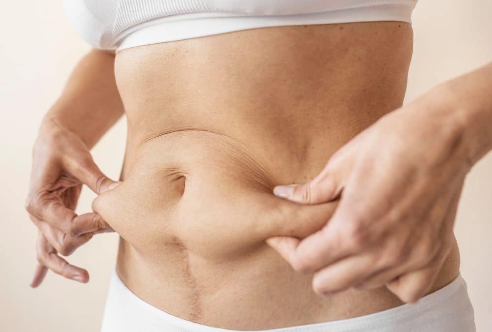 How painful is liposuction?