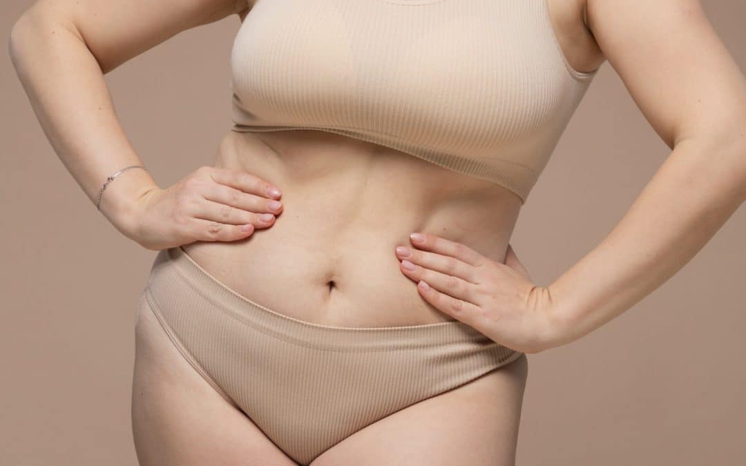 What happens to your body after a tummy tuck?