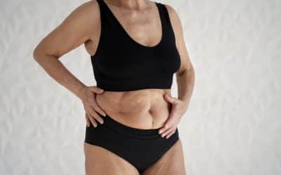 Things to Consider Before a Liposuction Operation