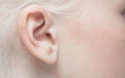 Is Ear Pinning Right for You? Understanding the Benefits of Otoplasty