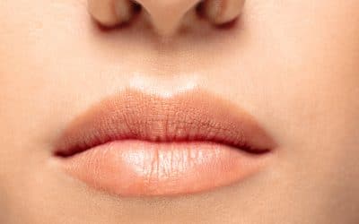 Lip Lift vs. Fillers: Which is Right for You?