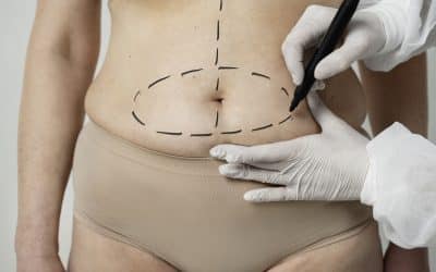 Alleviating Your Fears About Plastic Surgery