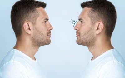 Male rhinoplasty – what is it, what’s the difference and what’s involved?