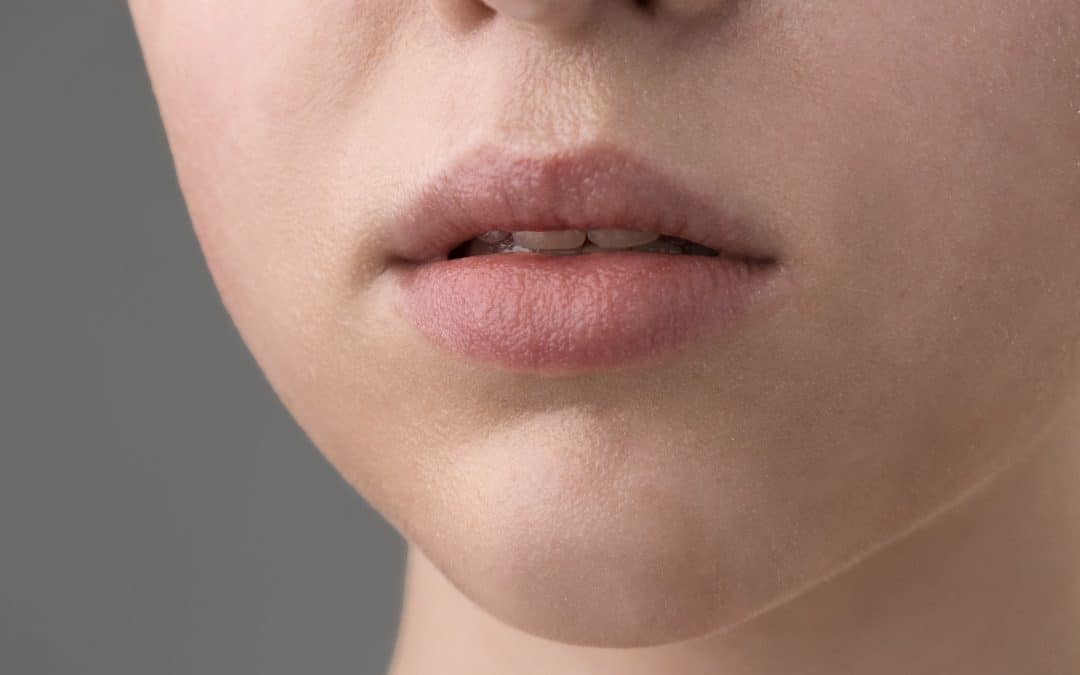 Lip Lift Surgery: Your Essential Guide