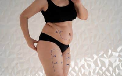 Body Contouring After Weight Loss: Surgical Options That Deliver Real Results